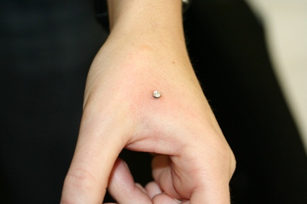 Tidak Lagi Gunakan Cincin Pernikahan, Tindik Jari Tangan Menjadi Hits dan Sekaligus Berbahaya Tidak Lagi Gunakan Cincin Pernikahan, Tindik Jari Tangan Menjadi Hits dan Sekaligus Berbahaya